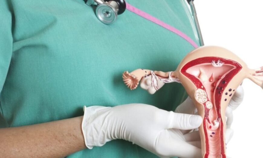 Mioma &eacute; segunda maior causa de cirurgia em mulheres - ViDA & A&ccedil;&atilde;o